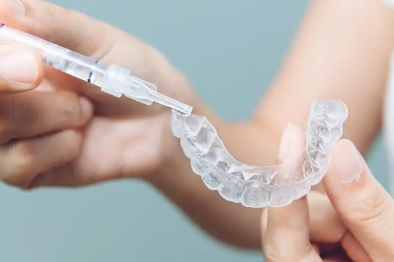 Co to jest Invisalign?