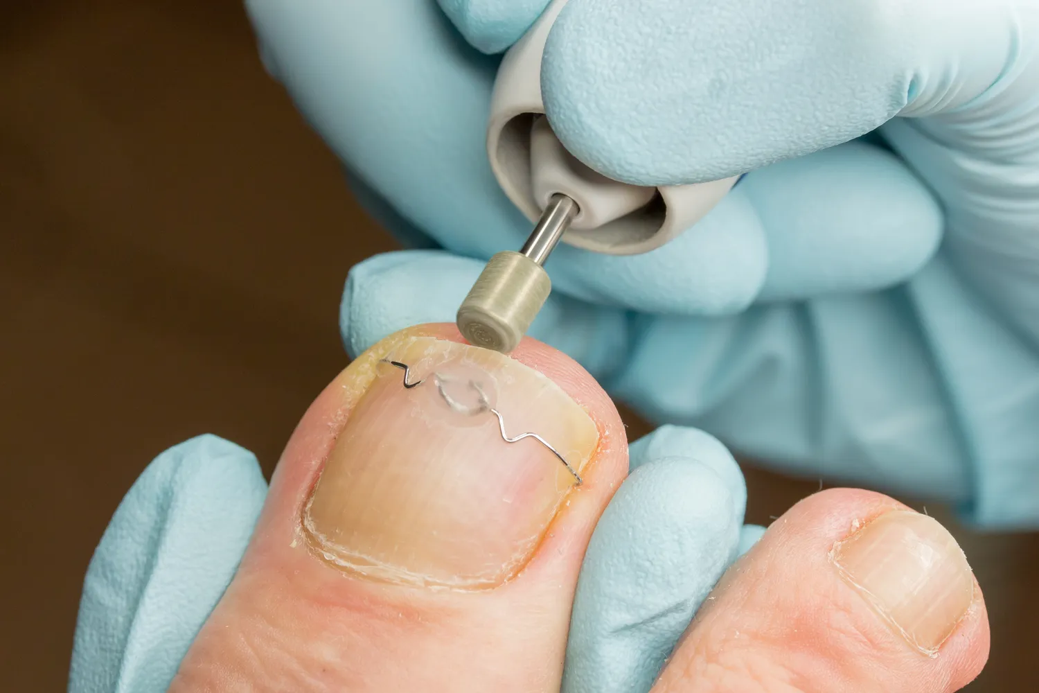 Dobry podolog a zdrowie i komfort stóp